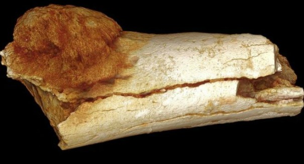 Scientists make shocking discovery on ancient human bone