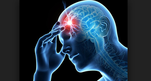 Discovery: It’s shockingly simple to avoid strokes